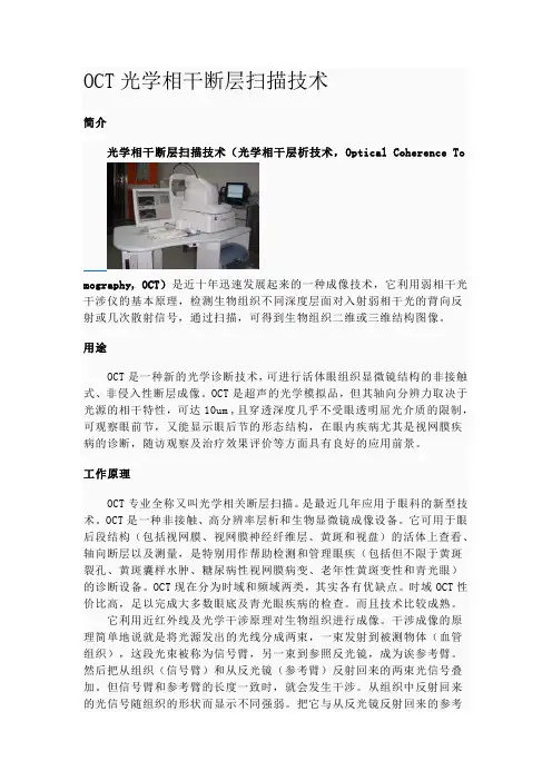 OCT光学相干断层扫描技术