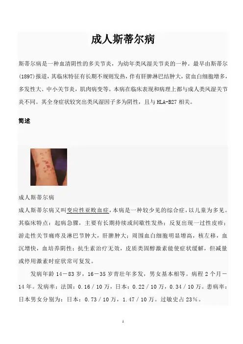 成人斯蒂尔病