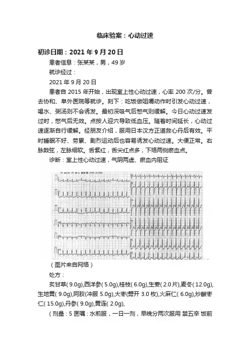临床验案：心动过速