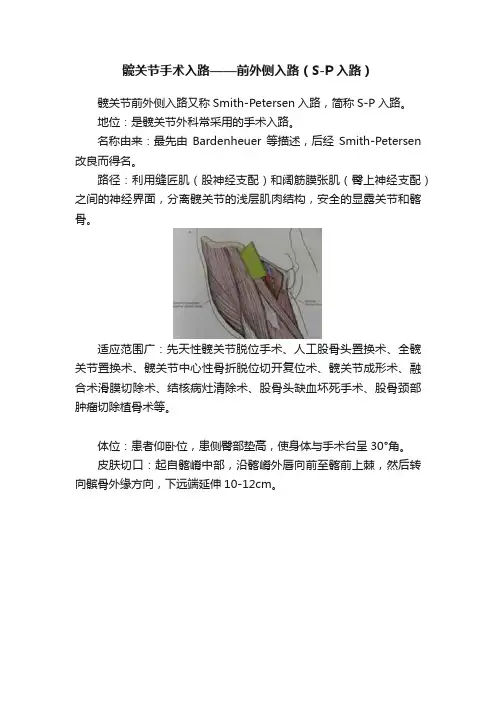 髋关节手术入路——前外侧入路（S-P入路）
