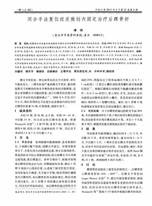 闭合手法复位经皮微创内固定治疗后踝骨折