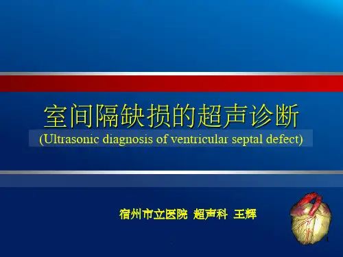 室间隔缺损超声诊断PPT课件