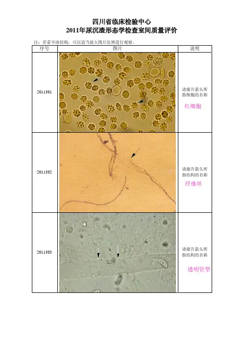汇总省 2011-17年合并尿沉渣形态学检查室间质量评价图片(附整理答案)