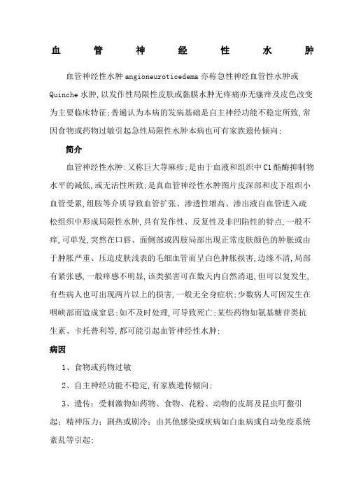 血管神经性水肿