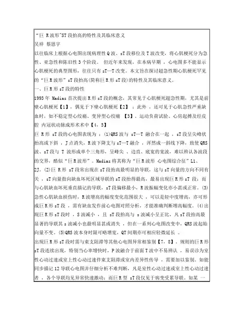“巨”R波形ST段抬高的特性及其临床意义
