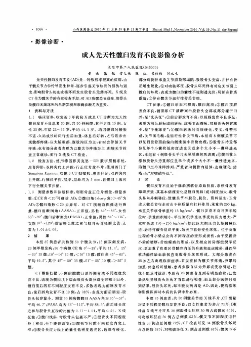 成人先天性髋臼发育不良影像分析