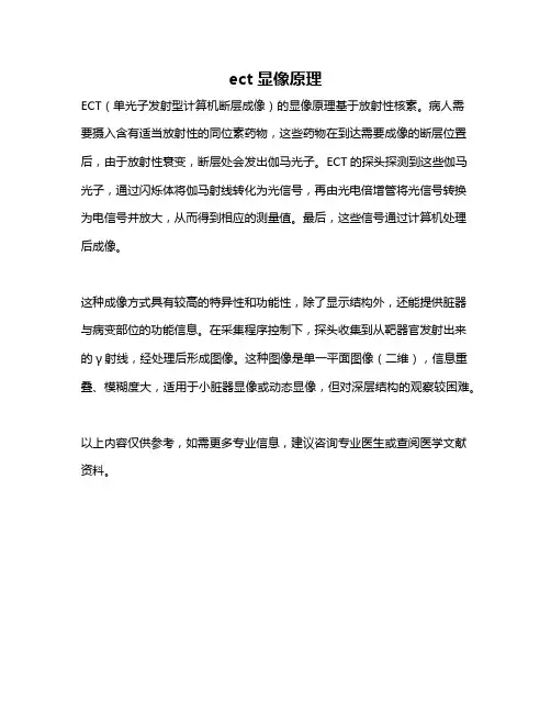 ect显像原理