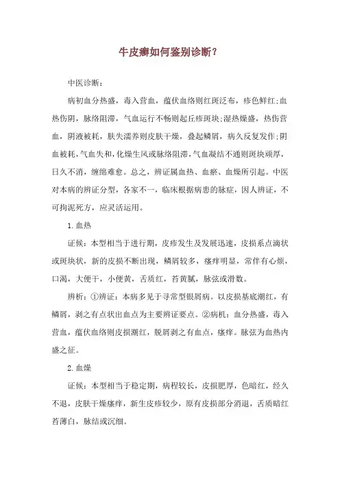 牛皮癣如何鉴别诊断？