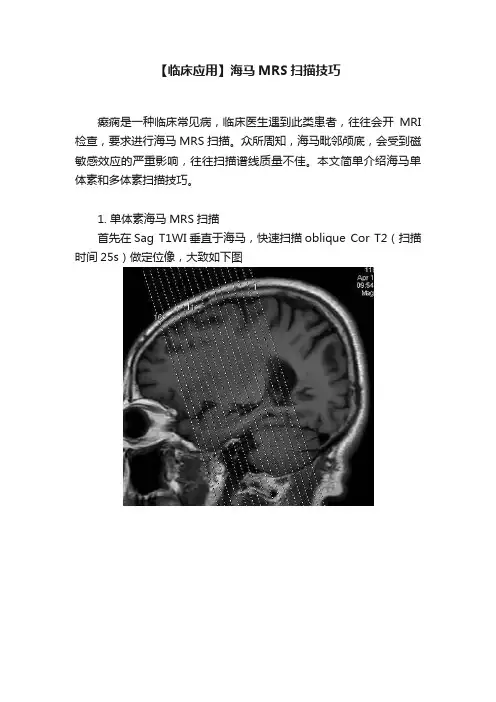 【临床应用】海马MRS扫描技巧