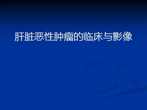 肝脏恶性肿瘤临床与影像PPT课件