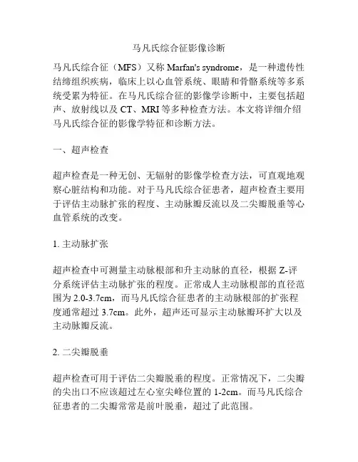 马凡氏综合征影像诊断