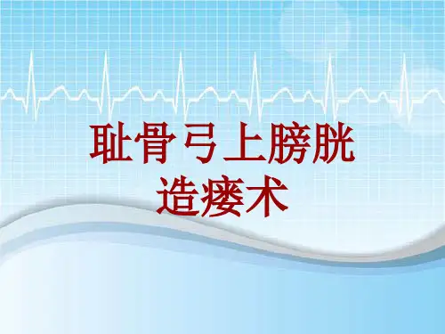 外科手术教学资料：耻骨弓上膀胱造瘘术讲解模板