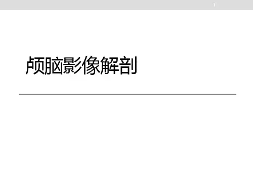 颅脑影像解剖精品PPT课件