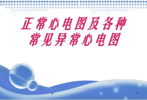 正常心电图及各种异常心电图