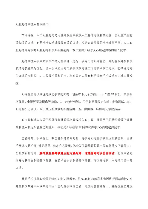 心脏起搏器植入基本操作