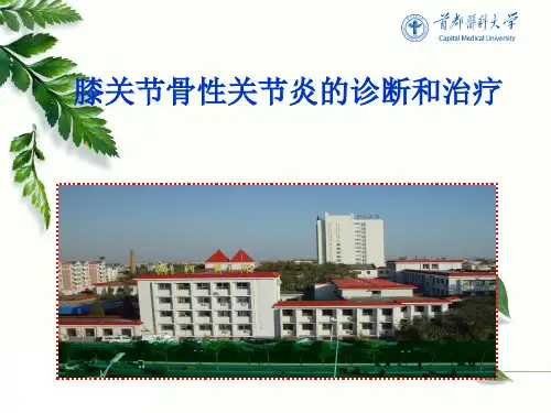 骨性关节炎的诊断和治疗