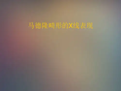 马德隆氏畸形X表现