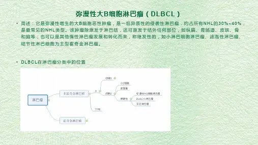 弥漫性大B细胞淋巴癌 病理诊断及鉴别诊断