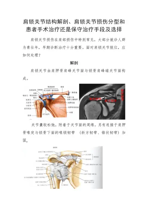 肩锁关节结构解剖、肩锁关节损伤分型和患者手术治疗还是保守治疗手段及选择