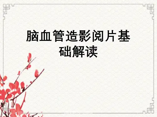 脑血管造影阅片基础解读
