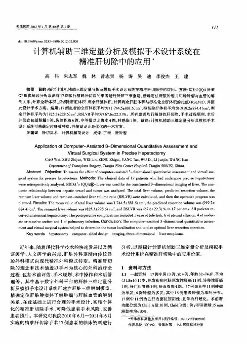 计算机辅助三维定量分析及模拟手术设计系统在精准肝切除中的应用