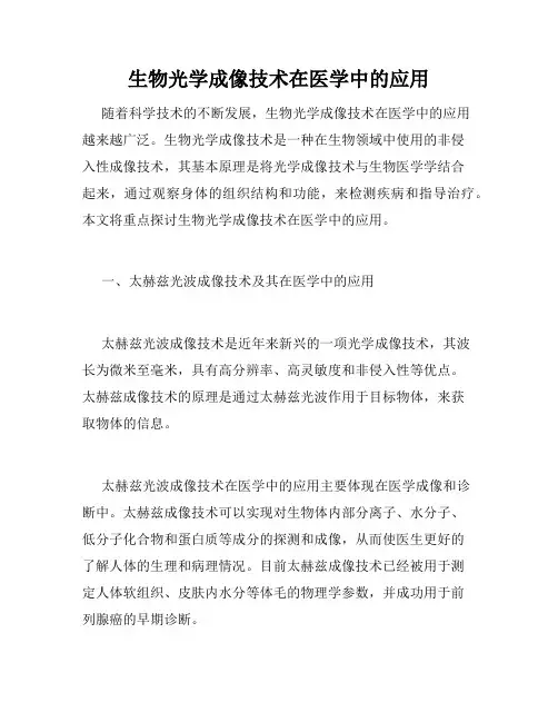 生物光学成像技术在医学中的应用