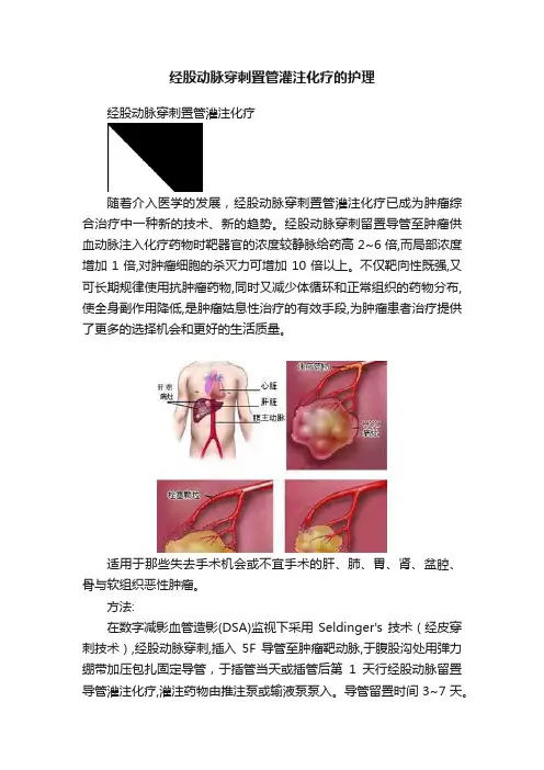 经股动脉穿刺置管灌注化疗的护理