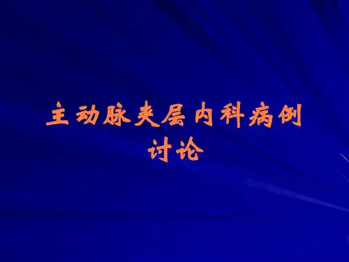 主动脉夹层内科病例讨论