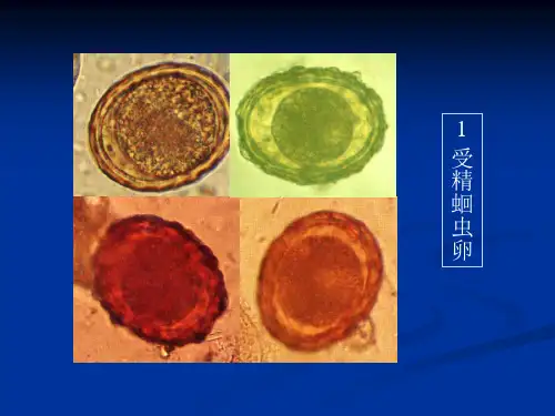 人体寄生虫学标本复习精品PPT课件