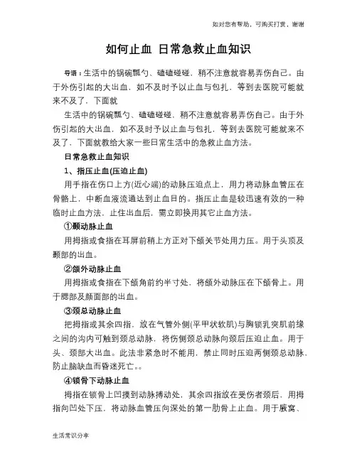 如何止血 日常急救止血知识