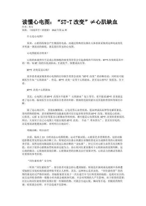 读懂心电图：“ST-T改变”≠心肌缺血