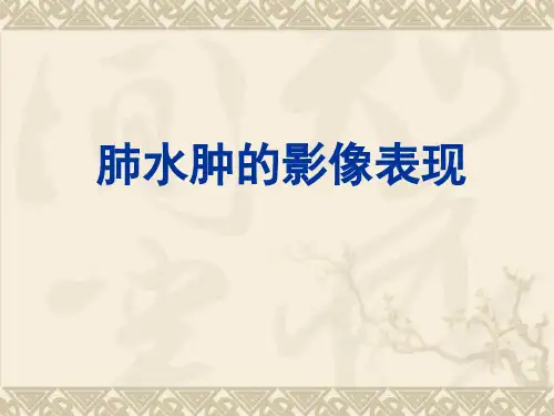 肺水肿的影像表现ppt课件
