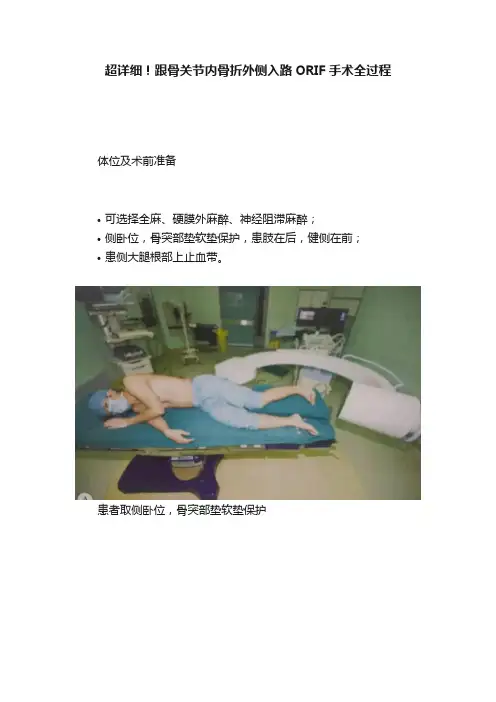 超详细！跟骨关节内骨折外侧入路ORIF手术全过程