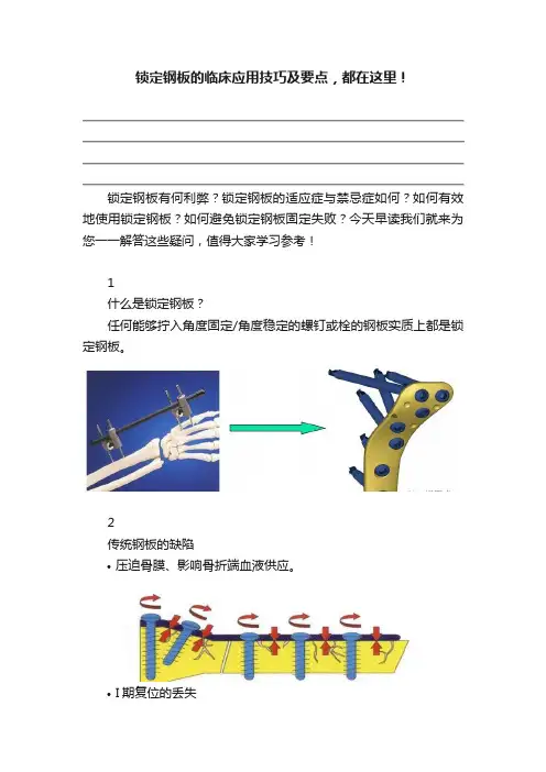 锁定钢板的临床应用技巧及要点，都在这里！