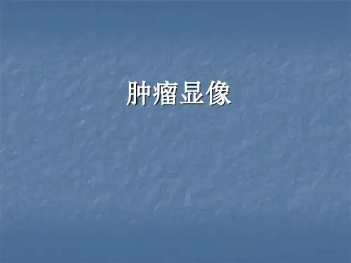 肿瘤显像核医学医学