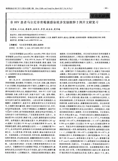 非HIV患者马尔尼菲青霉菌感染致多发脑脓肿2例并文献复习