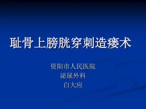 耻骨上膀胱穿刺造瘘术