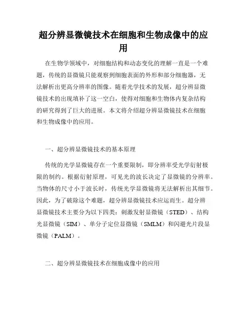 超分辨显微镜技术在细胞和生物成像中的应用