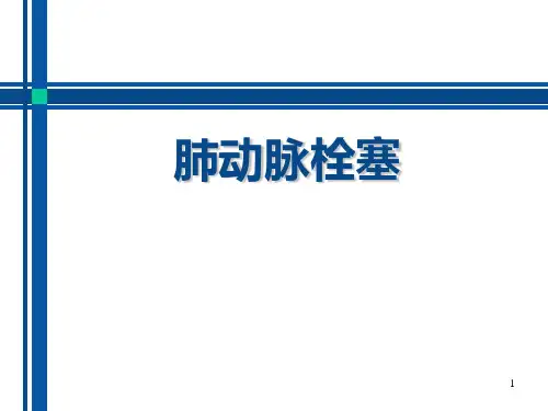 肺动脉栓塞PPT幻灯片课件