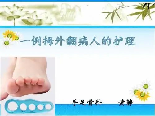 拇外翻个案护理 ()ppt课件