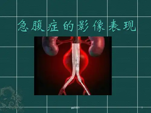 急腹症的影像表现  ppt课件