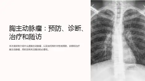 《胸主动脉瘤》课件
