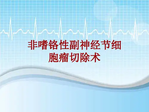 手术讲解模板：非嗜铬性副神经节细胞瘤切除术