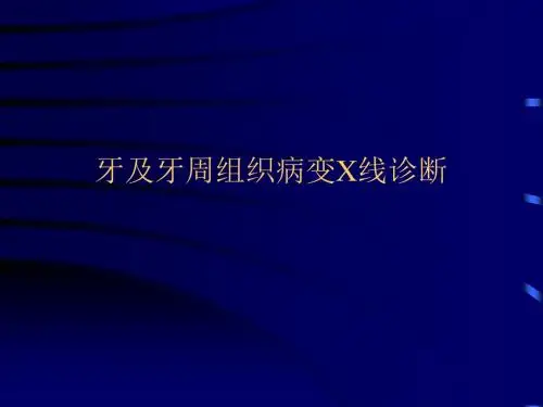 牙及牙周组织病变X线诊断