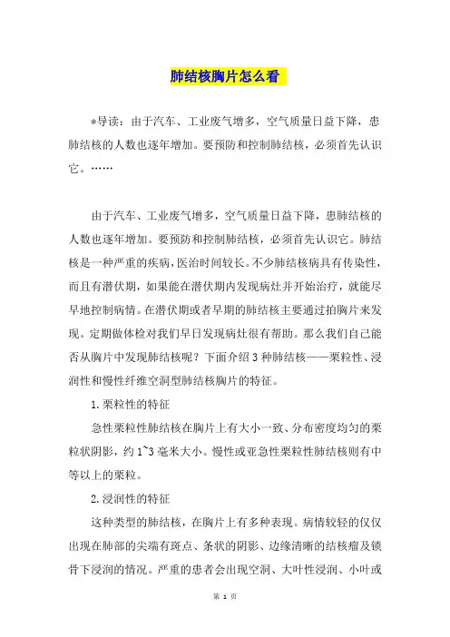 肺结核胸片怎么看