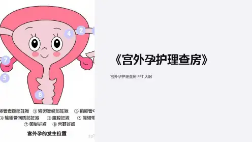 《宫外孕护理查房》课件