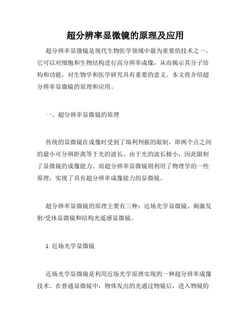超分辨率显微镜的原理及应用