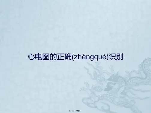 心电图的正确识别