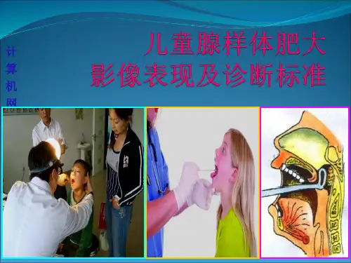 儿童腺样体肥大影像表现及诊断标准