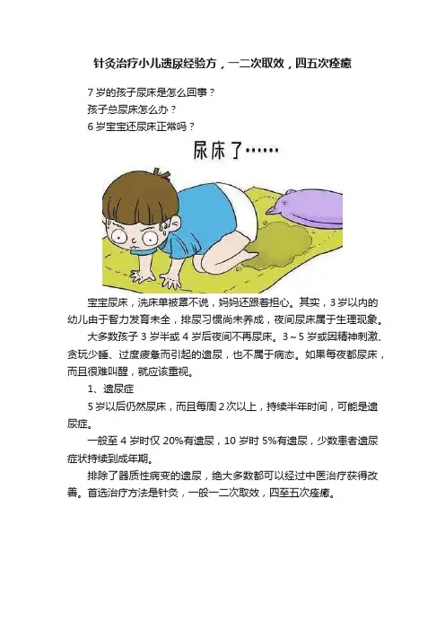 针灸治疗小儿遗尿经验方，一二次取效，四五次痊癒